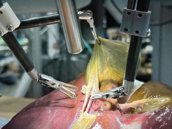 SURGERY