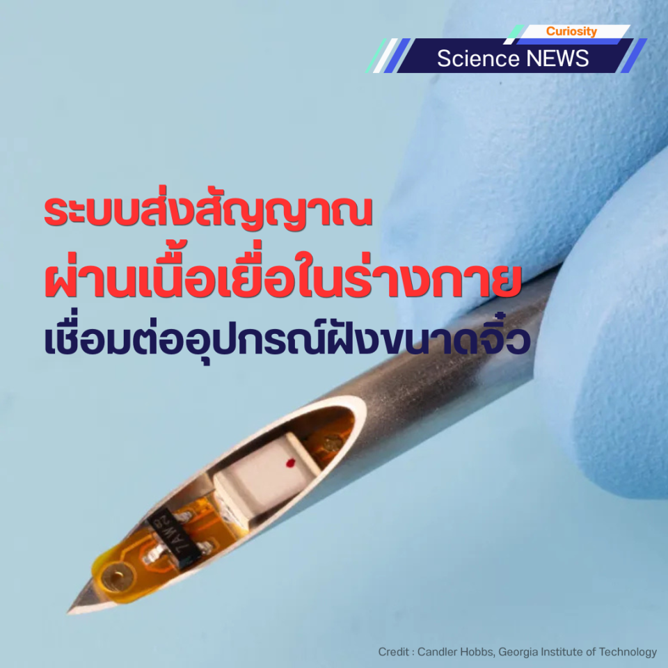 ระบบส่งสัญญาณผ่านเนื้อเยื่อในร่างกาย เชื่อมต่ออุปกรณ์ฝังขนาดจิ๋ว