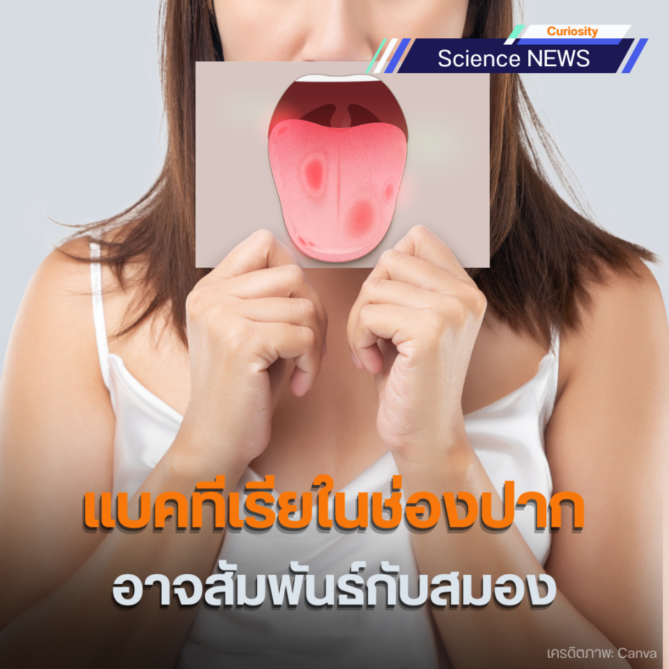 แบคทีเรียในช่องปากอาจสัมพันธ์กับความเร็วในการคิดและการประมวลผลของสมอง