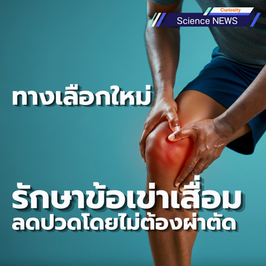 ทางเลือกใหม่รักษาข้อเข่าเสื่อม ลดปวดโดยไม่ต้องผ่าตัด